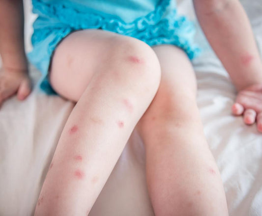 The 3 Best Ways to Prevent Bed Bugs in Florida - City Mattress Staging